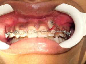 Dscf2729 h8j05p - Eugenol