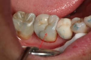 Dudule blanc yr3ebu - Eugenol