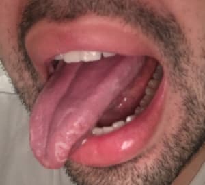 E0e066f0 71e8 4e03 ae76 27ec986a31d5 volxma - Eugenol