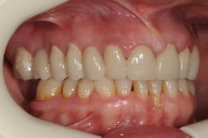 Edapres ldre4k - Eugenol