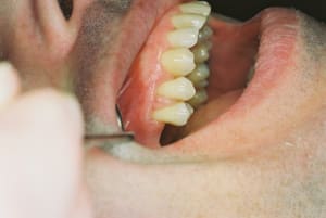 F1000004 z3n8ww - Eugenol