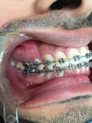 F3fdea48 b32d 4ade 82ff ddd3893a4535 errfnp - Eugenol