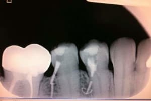 Fb img 1526224782839 tkrdsz - Eugenol