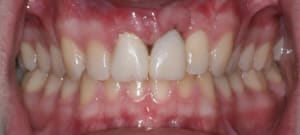 Face11 21 smqkex - Eugenol