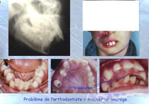 Franc avant cjhgse - Eugenol