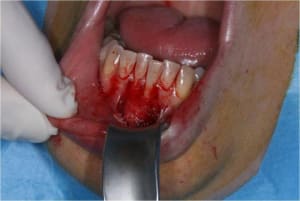 Gec2 frwfcy - Eugenol