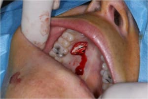 Gec4 hd0ztp - Eugenol