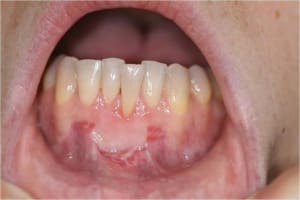 Gec8 d8miai - Eugenol