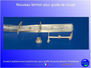 Guide de coupes pour greffe fibula  p ron    positdental 030 dtzkxt - Eugenol