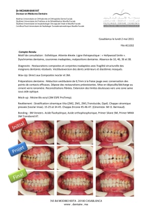Hollywood smile file 11032 joi0me - Eugenol