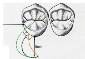 Housset mod txvzvv - Eugenol