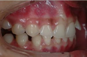 I1 l8rueg - Eugenol