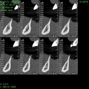 Img13 roafkk - Eugenol