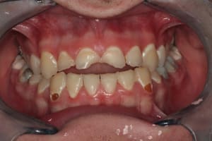 Img 0012red excd4b - Eugenol