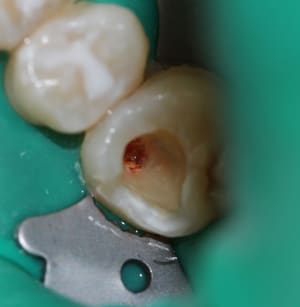 Img 0036 i1orki - Eugenol