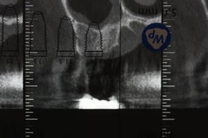 Img 0100 aeb9tf - Eugenol