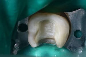 Img 0127 cytmj4 - Eugenol