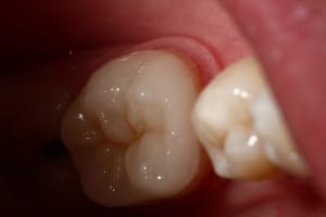 Img 0132 agkvcy - Eugenol