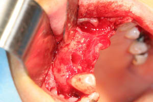 Img 0161 kerar8 - Eugenol