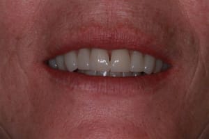 Img 0192 xjjkfp - Eugenol