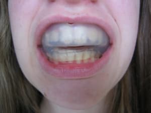 Img 0382 fh7o7h - Eugenol