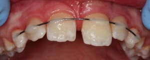 Img 0418 awvn9n - Eugenol
