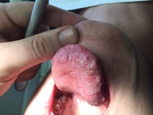 Img 0422 lwwz8r - Eugenol