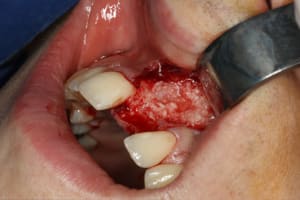 Img 0537 bphbdc - Eugenol