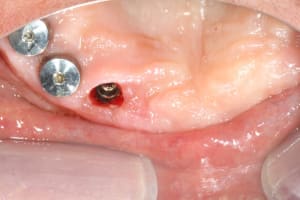 Img 0553 yjqx1j - Eugenol