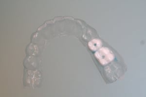 Img 0688 lj1b2s - Eugenol