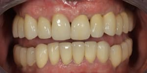 Img 0723 q9y0fd - Eugenol