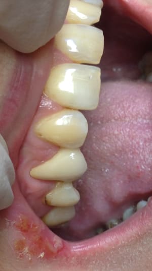 Img 0803 acjoxv - Eugenol