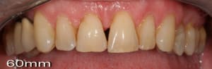 Img 0811 kcacsr - Eugenol