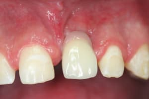Img 0919 afoatx - Eugenol