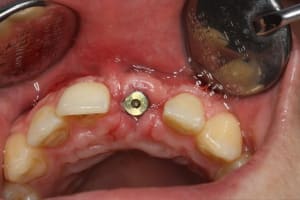Img 1132 scwwyy - Eugenol