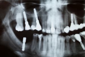 Img 1247 small n9dqrk - Eugenol