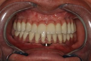 Img 1258 k7lprm - Eugenol