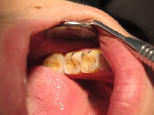Img 1269 cat0wo - Eugenol