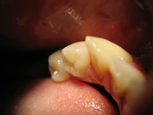 Img 1513 pthcrp - Eugenol