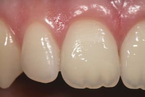Img 1589 fgrcoy - Eugenol
