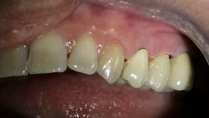 Img 1599.jpg08.02 - Eugenol