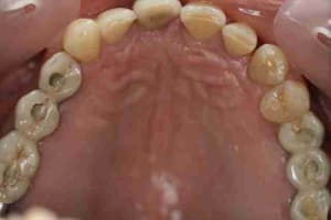 Img 1639 d8wgdl - Eugenol
