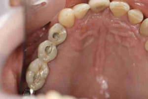 Img 1640 cfqe0d - Eugenol
