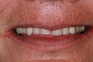 Img 1682 sktcmt - Eugenol