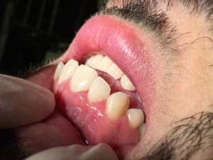 Img 1780 yg01cm - Eugenol