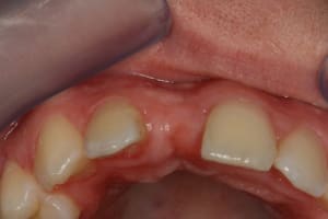Img 1881 er2xcy - Eugenol