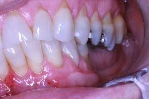Img 1997 r6ivnq - Eugenol