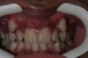 Img 1 0477 gllgih - Eugenol