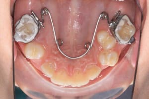 Img 1  udvmai - Eugenol
