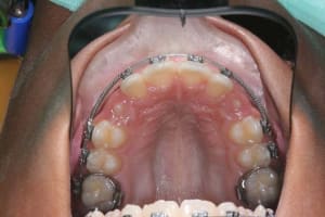 Img 1 e4jcmn - Eugenol